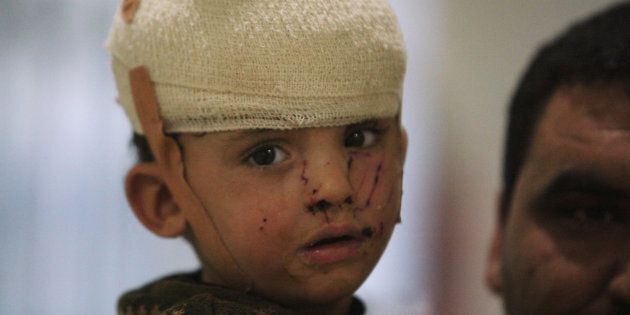 A displaced child who was injured in clashes and fleeing from Islamic State militants of Mosul, receives treatment at a hospital west of Erbil, Iraq.