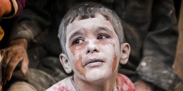 ALEPPO, SYRIA - OCTOBER 11: A wounded Syrian kid cries after the war-crafts belonging to the Russian army bombed the opposition controlled Firdevs neighborhood in Aleppo, Syria on October 11, 2016. (Photo by Jawad al Rifai/Anadolu Agency/Getty Images)