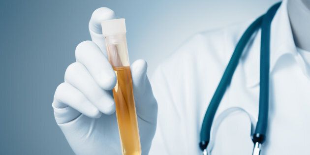 There's a popular notion that urine is sterile, but recent research suggests that's not true.