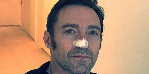 Hugh Jackman has undergone a sixth treatment for skin cancer.