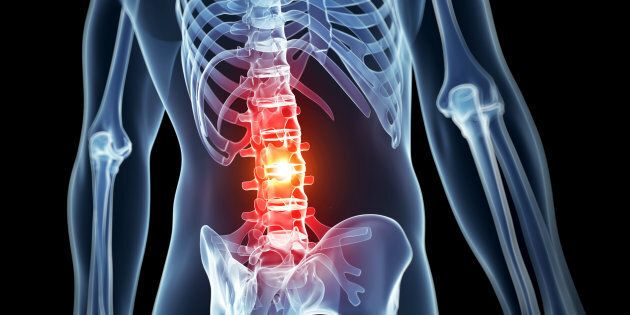 Intravenous immunoglobulin therapy could reduce harmful inflammation from spinal injuries.