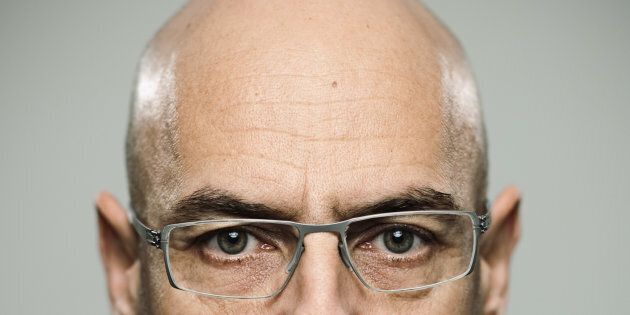 Short, white men are more likely to go bald