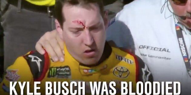 NASCAR driver Kyle Busch was left with a bloody gash on his forehead following a brawl at the Las Vegas Motor Speedway on Sunday.