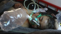 The Chemical Attack In Syria Should Be Sufficient To Shock The World Into