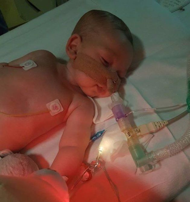 Charlie is in intensive care and relies on a ventilator to keep him alive.