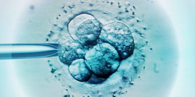 Around one in every 25 children are now born through in vitro fertilisation in Australia.