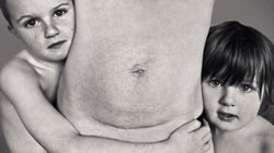 I Hate Many Things About My Body, But These Wounds Are Not One Of