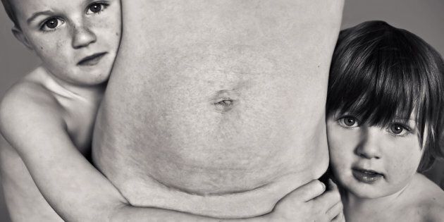So many people are embarrassed of their post-baby body, some even ashamed of a c-section scar -- but look at what came from it.