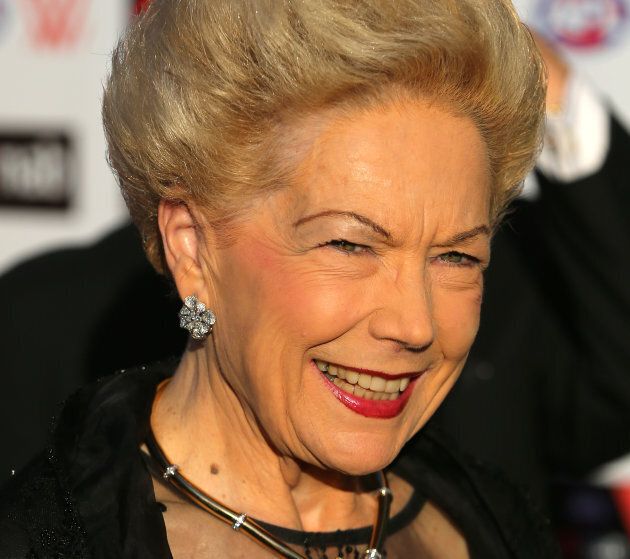 Businesswoman and philanthropist Susan Alberti was the first woman elevated to AFL corporate level and became a trailblazer in the movement towards a national women's AFL competition.