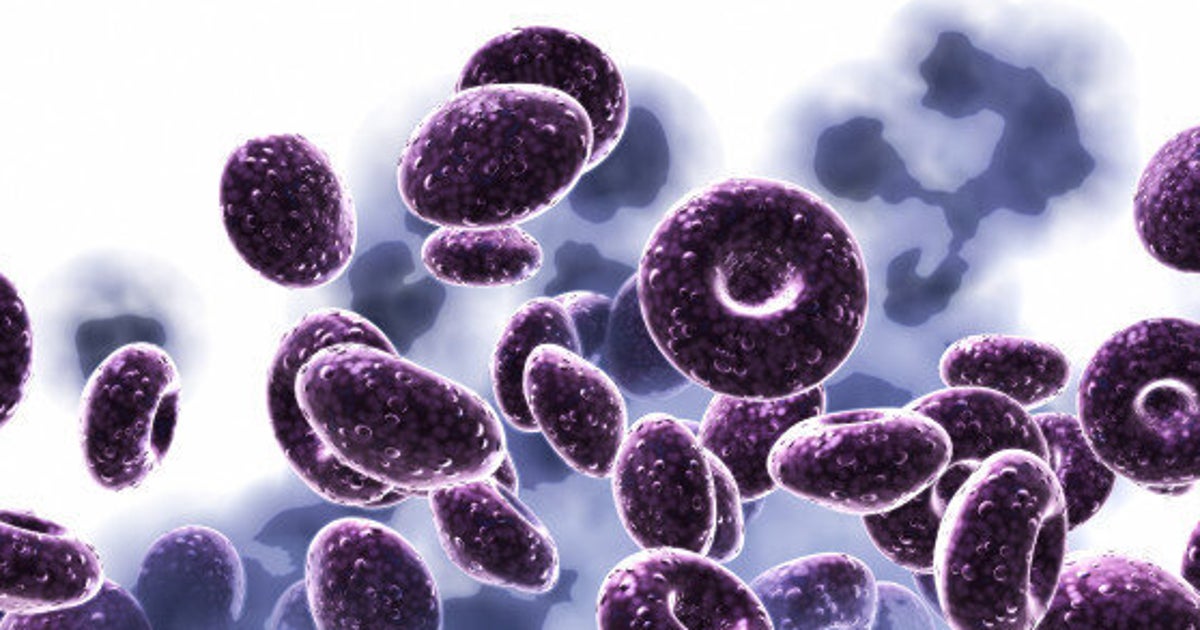 Influenza A virus subtype H5N1 visual data 5