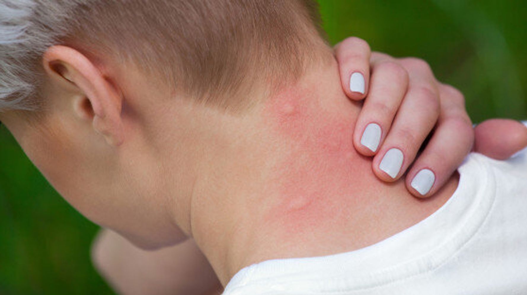 how-to-prevent-mosquito-bites-outside-and-indoors-huffpost-canada-life