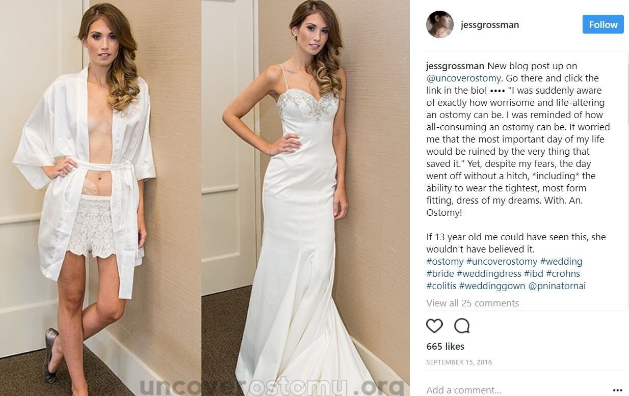 dresses for 13 year olds to wear to a wedding