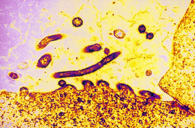 Color-enhanced transmission electron micrograph (TEM) of respiratory syncytial virus (RSV).