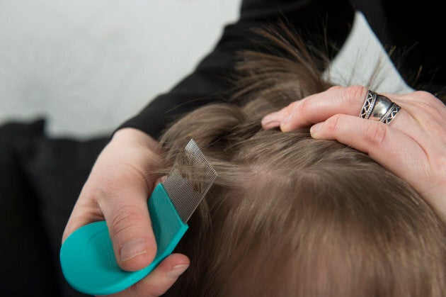 Check the head thoroughly with a fine comb.