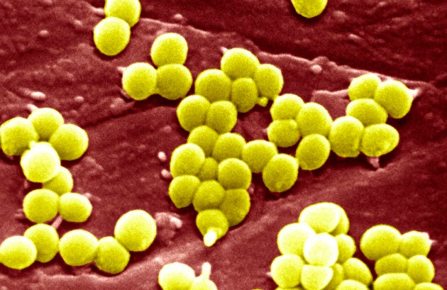 Distinguishing Deadly Staph Bacteria from Harmless Strains