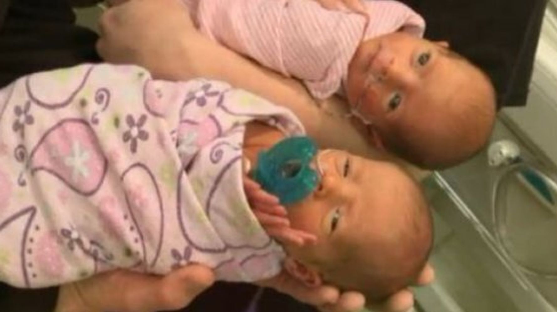 Mom Gives Birth To Rare Twins Not Knowing She Was Pregnant Huffpost Life