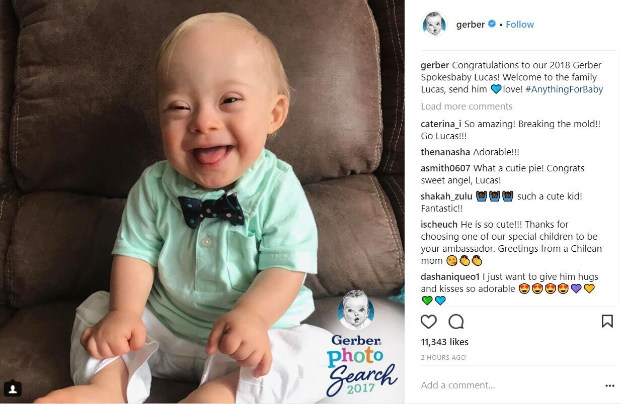 2018 gerber baby photo contest