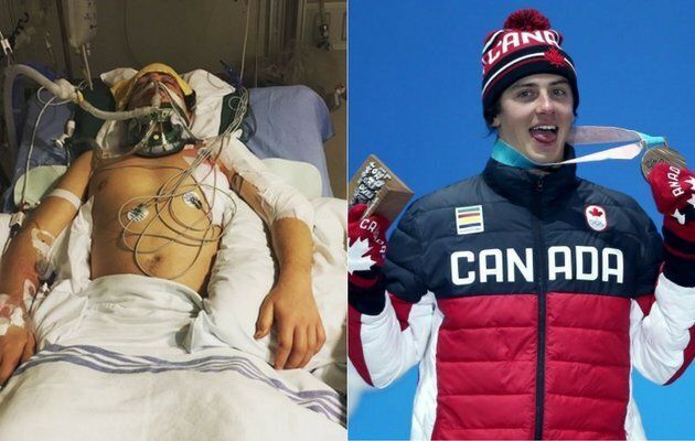 Mark McMorris nearly died after suffering a snowboarding injury near Whistler, B.C. Earlier this month he won an Olympic medal.