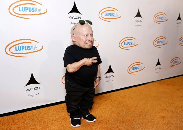 Actor Verne Troyer attends an event on September 21, 2016 in Los Angeles, California. Troyer died on Saturday.