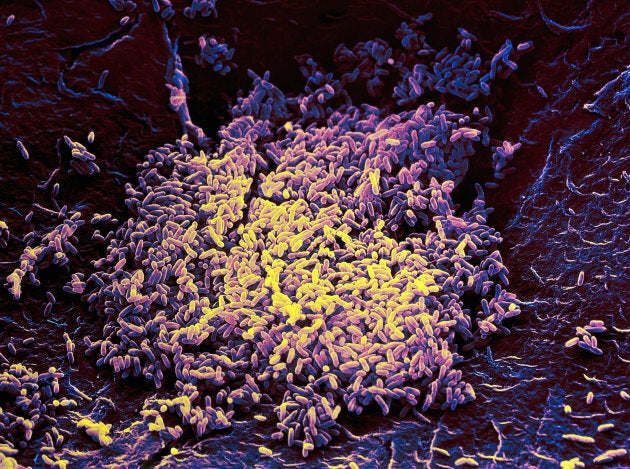 Listeria monocytogenes bacteria.