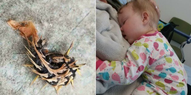 The remains of the caterpillar, left, are seen after eight-month-old Kenzie Pyne, right, put it in her mouth. The baby is recovering now, said her mom.
