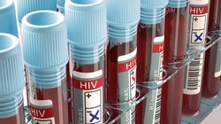 Our Highest Court's Position On HIV Disclosure Is Steeped In