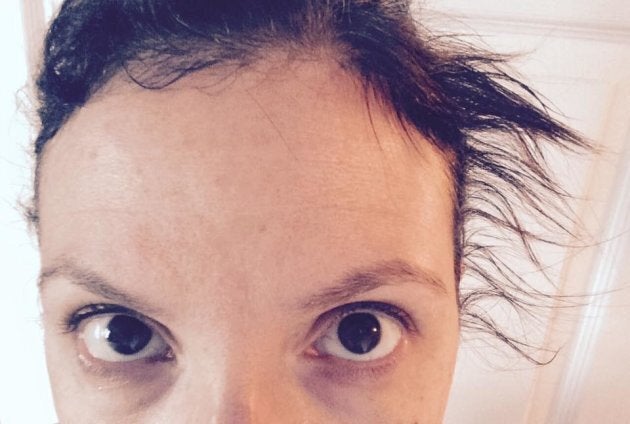 Postpartum Hair Loss Is The Pregnancy Side Effect I Just Can T Get Past Huffpost Canada Parents