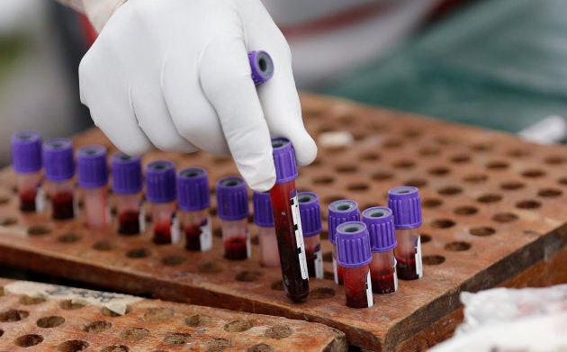 A medic arranges blood samples donated during a Valentine's Day campaign in Nairobi, Kenya on February 14, 2018.