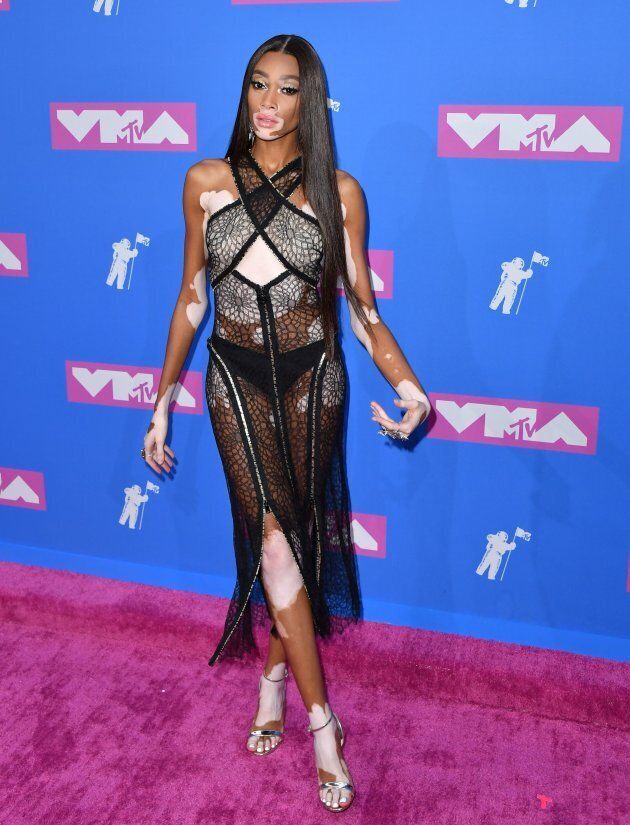 Canadian model Winnie Harlow attends the 2018 MTV Video Music Awards at Radio City Music Hall on Aug. 20, 2018 in New York City.
