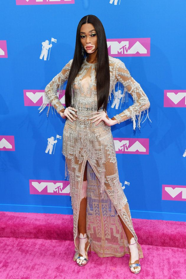 Winnie Harlow attends the 2018 MTV Video Music Awards at Radio City Music Hall on Aug. 20, 2018 in New York City.