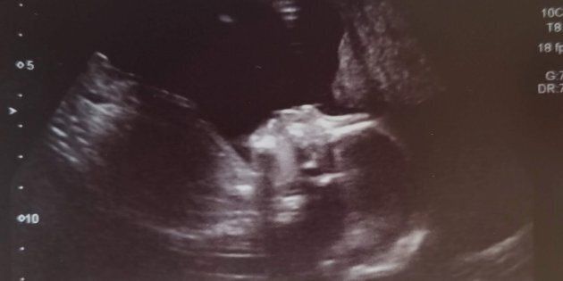Introducing our daughter at 20 weeks.