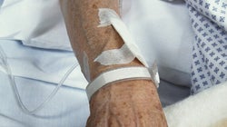 How to Reduce Wait Times in Canadian Health