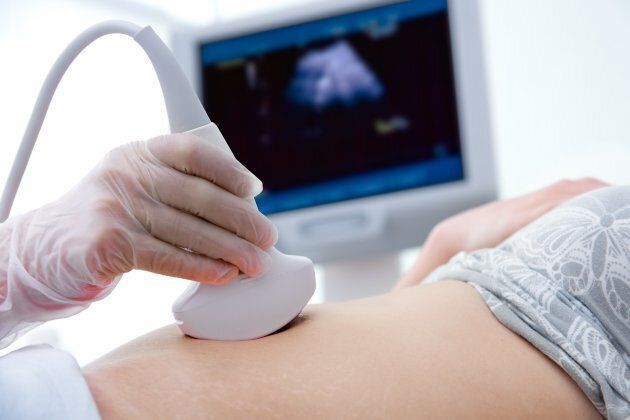 For those who have experienced miscarriages, ultrasounds aren't exactly exciting.