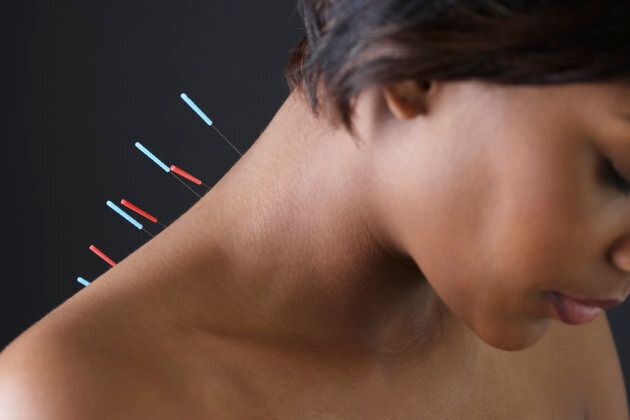 Canadian regularly turn to alternative therapies such as acupuncture.