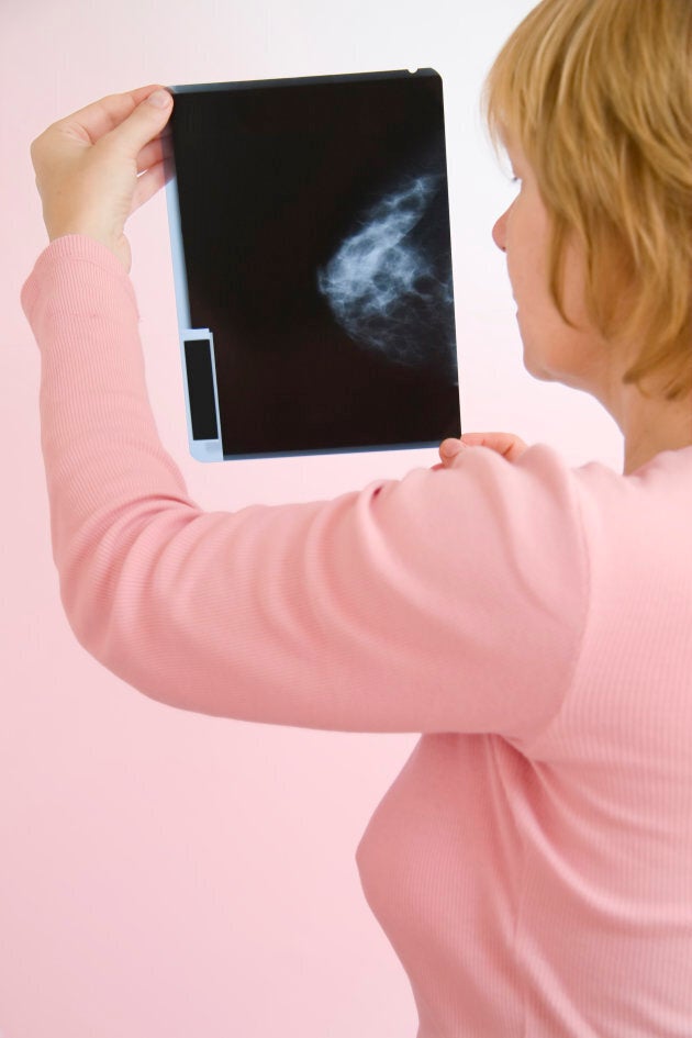 New guidelines encourage women aged 40 to 74 to discuss breast cancer screening with their doctors and make a shared decision about whether to get a mammogram based in part on a woman's preferences.