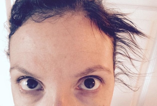 Postpartum Hair Loss Photos Show This Brutal Side Effect Of Mom Life | HuffPost Parents Postpartum Hair Loss Photos Show This Brutal Side Effect Of Mom Life | HuffPost Parents