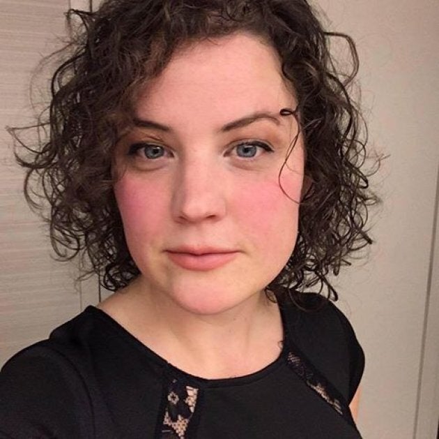 Karley Skoblenick, from Kingston, Ont., says she's anxious and embarrassed by her postpartum hair loss. (She also got rid of every photo where her hair loss is visible).