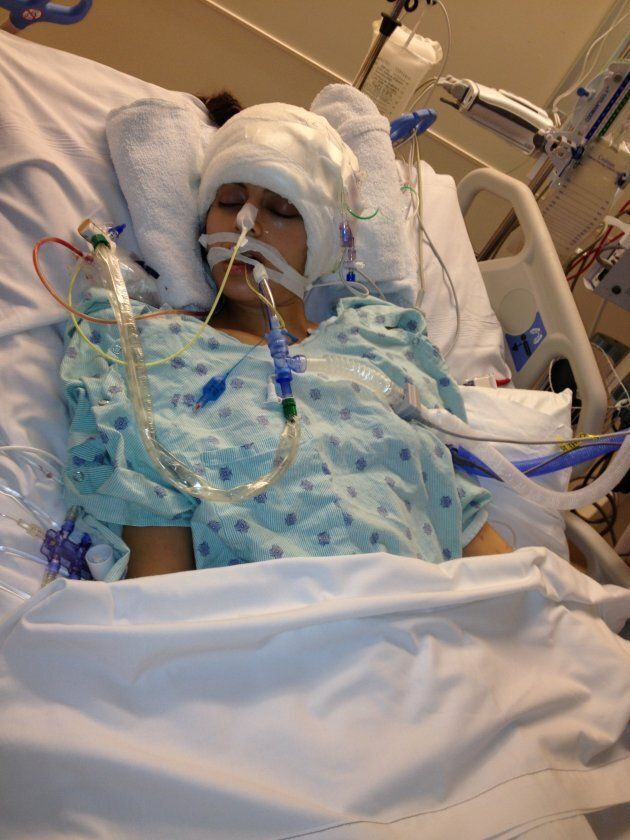 The author after two massive strokes requiring emergency brain surgery, Jan 2013.