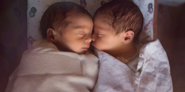 These newborn premature male fraternal twins have a better chance of surviving these days compared to decades earlier.