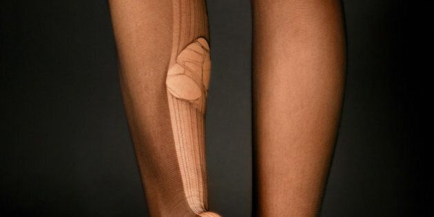 Back of Young Woman's Legs with Huge Run in Stockings