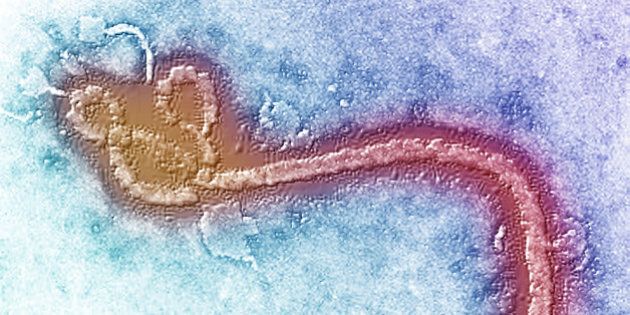 Ebola Zaire virus