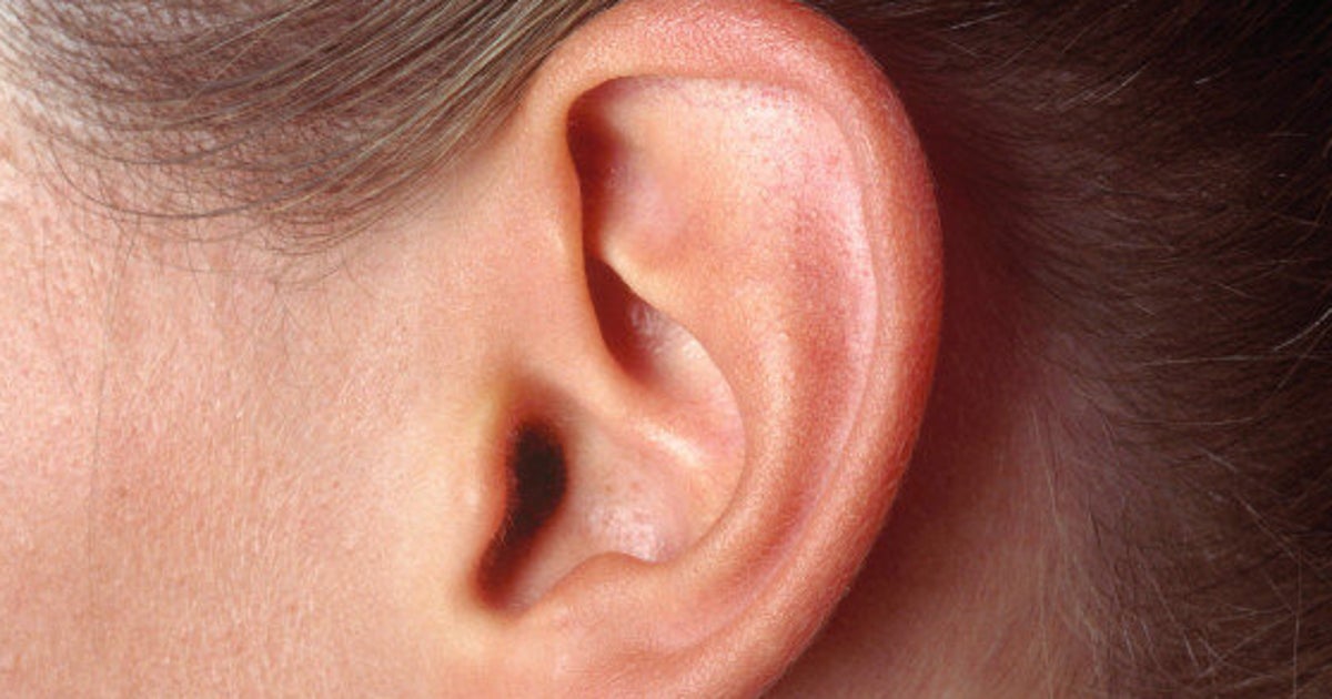 What Is Ear Wax, And How Do You Know If Yours Is Normal? HuffPost Life
