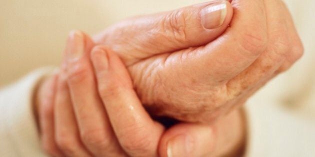 Arthritic hands. Elderly woman rubbing her arthritic sore hand. Arthritis is a degenerative disease that results in the loss of cartilage between joints, causing pain and inflammation.