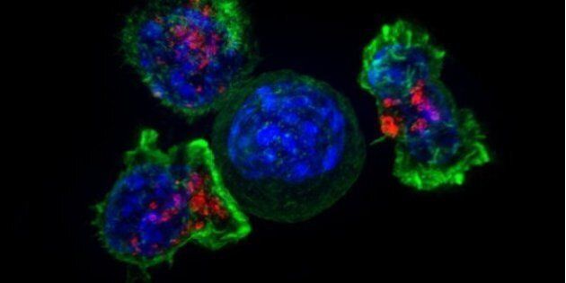 Killer T cells (green and red) surround a cancer cell (blue, center). Killer T cells are immune cells that target and remove unhealthy cells, including cancer cells and virus-infected cells. Credit: NICHD/J. Lippincott-Schwartz