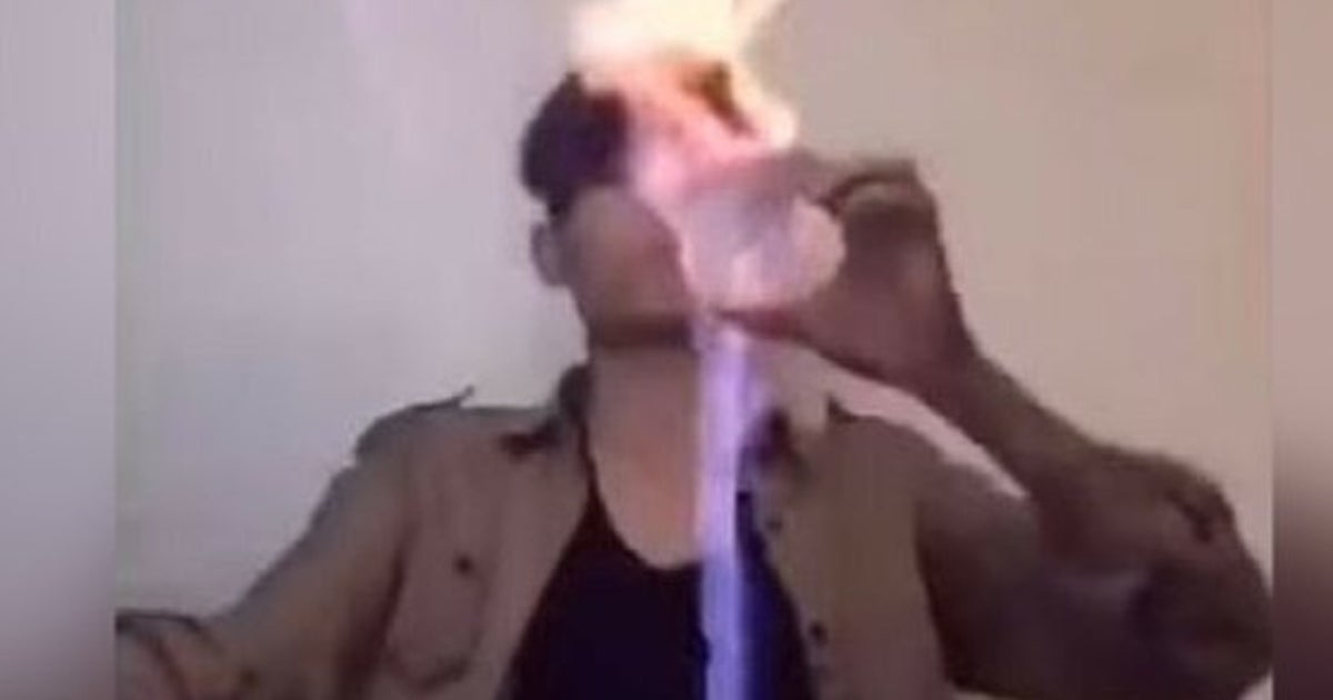 Here It Is, The Most Most Painful-To-Watch Video Of The Year | HuffPost ...