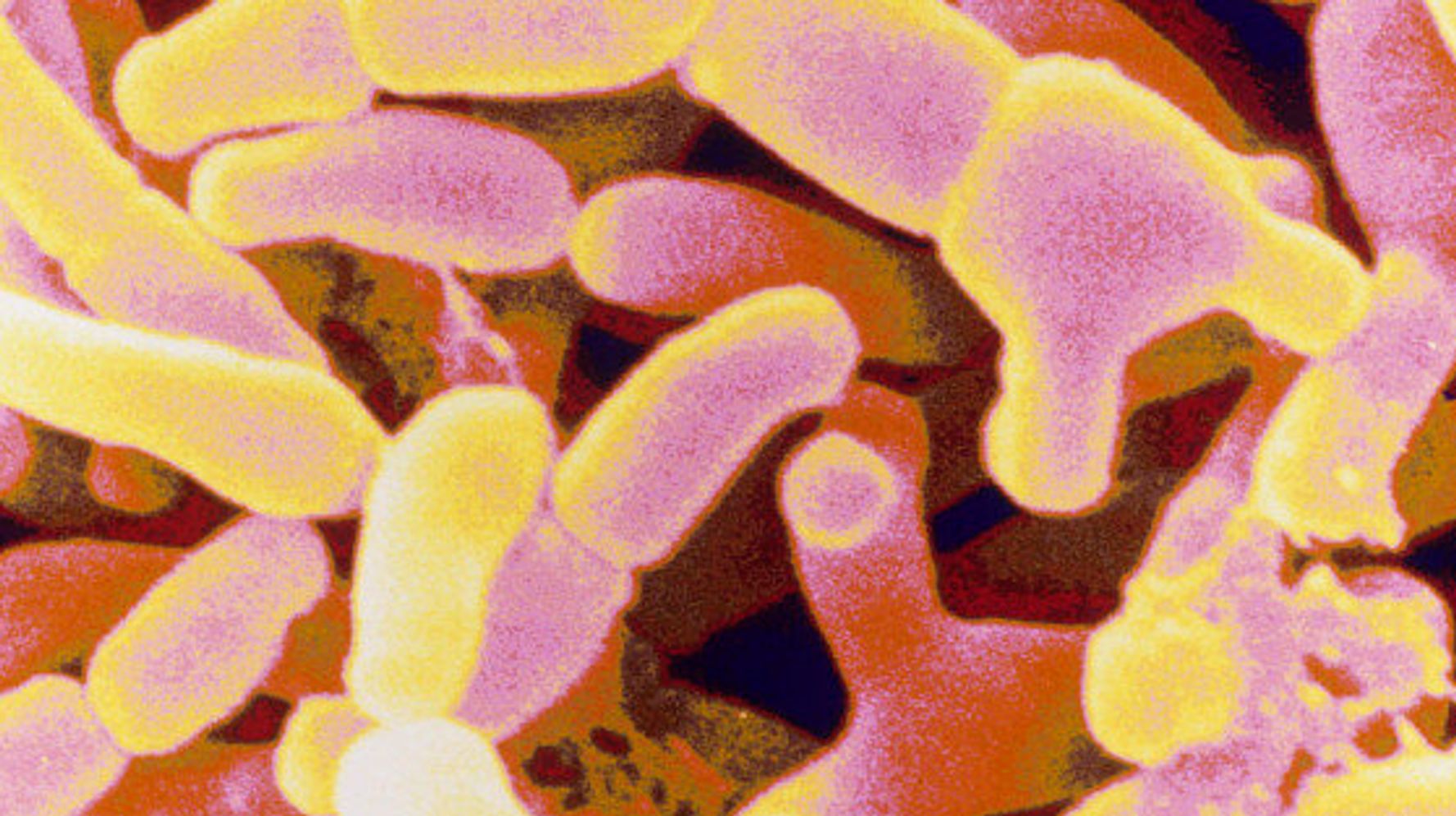 Probiotics Could Control "Inflammaging" | HuffPost Canada Life