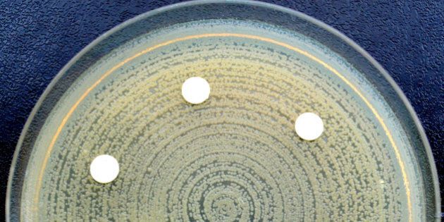 Multi-drug-resistant bacterium. Antibiotic sensitivity test. The bacterium is not sensitive to the tested antibiotics.
