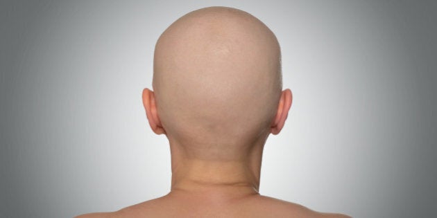 bald head rear view. file...