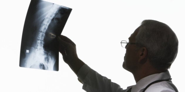 Mature man looking at X-ray image