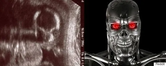 demon baby ultrasound